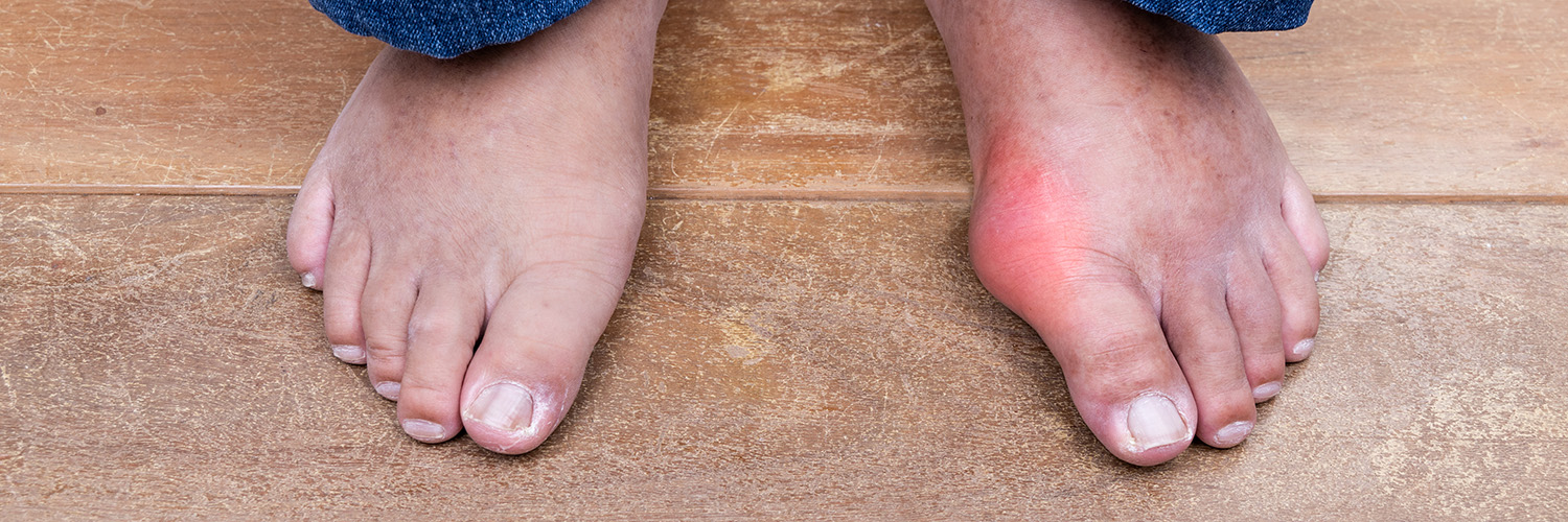 Gout services